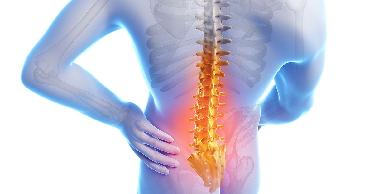 Parkland, FL Back Pain Treatment without Surgery