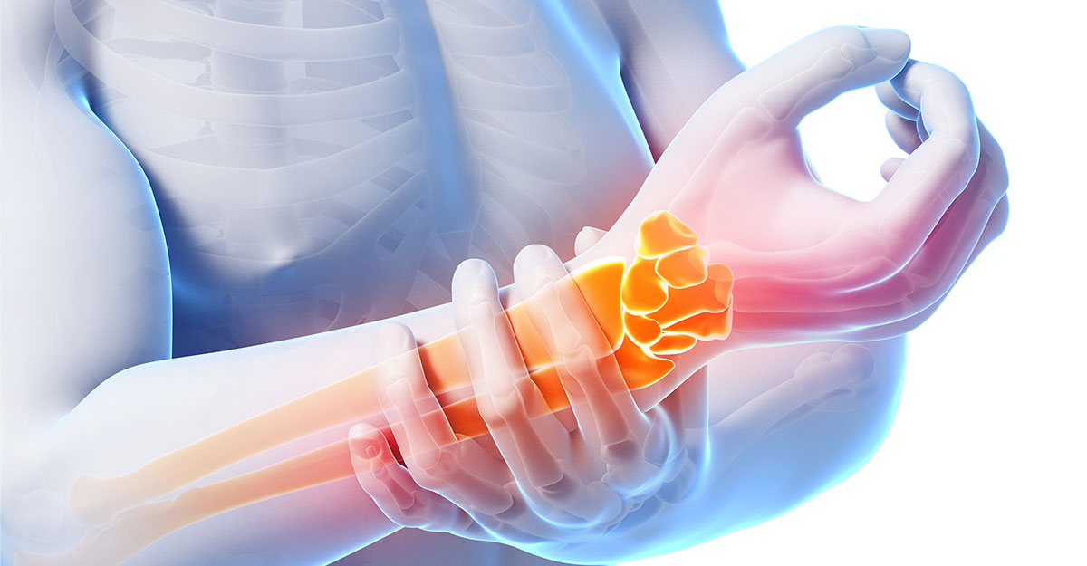 Parkland, FL natural carpal tunnel treatment