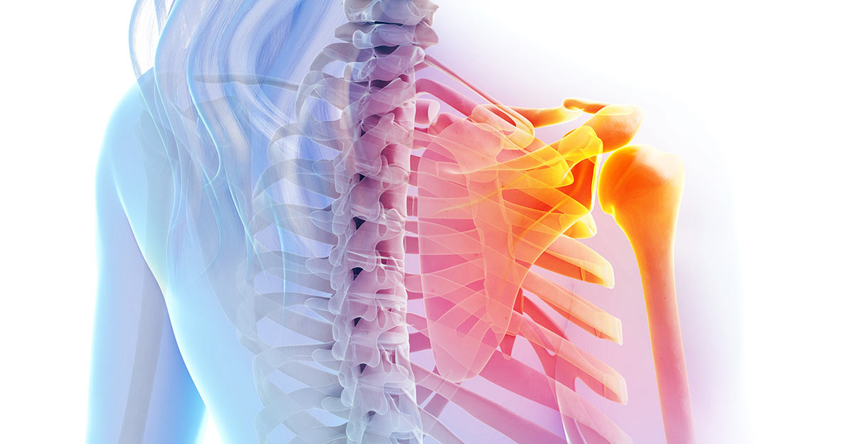 Parkland, FL shoulder pain treatment and recovery